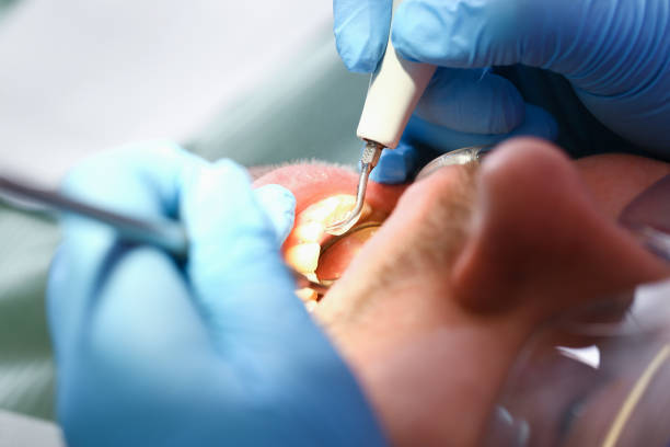 Best Emergency Dentist for Knocked-Out Tooth in Appalachia, VA
